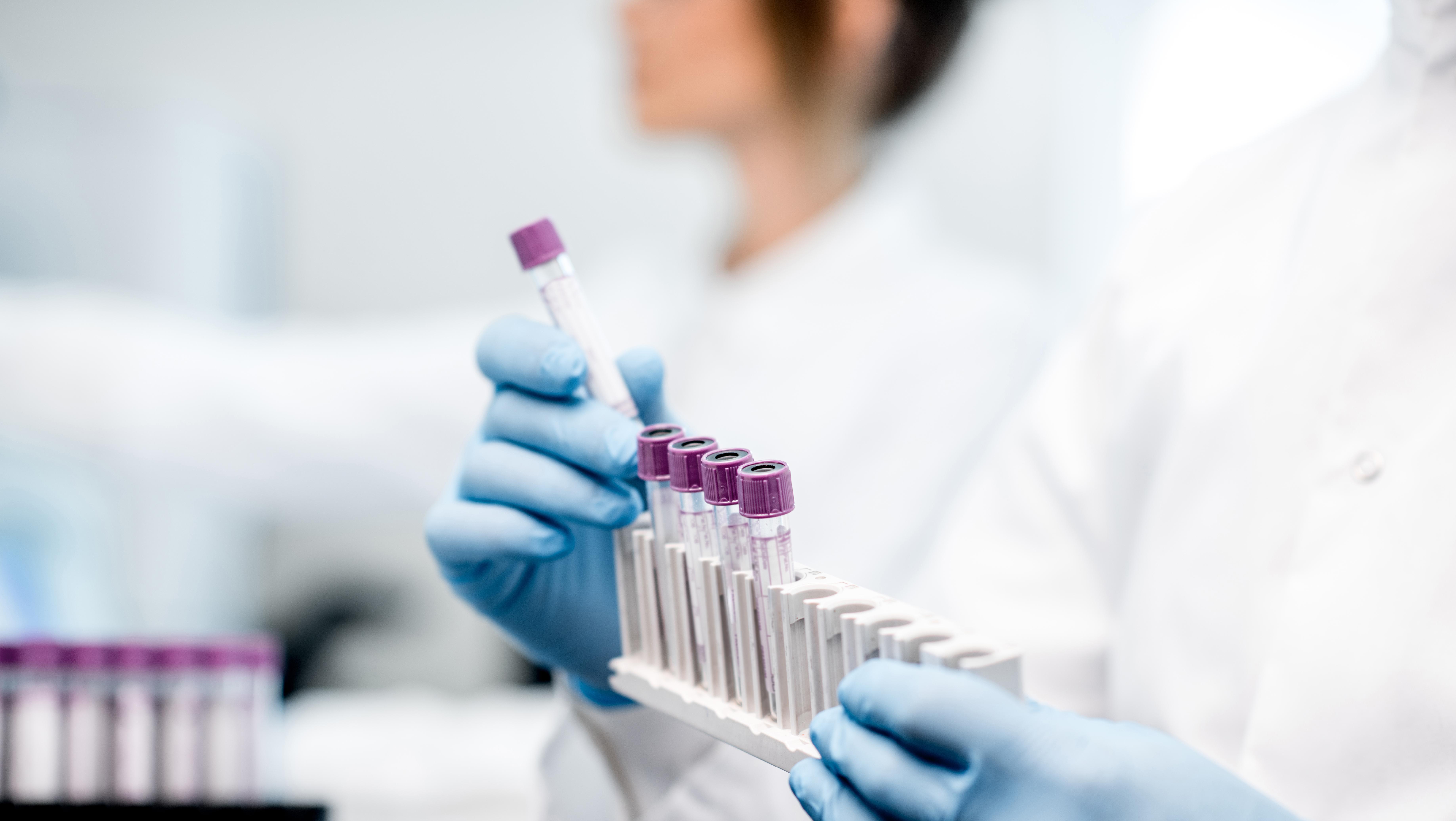 Гематология Гематология